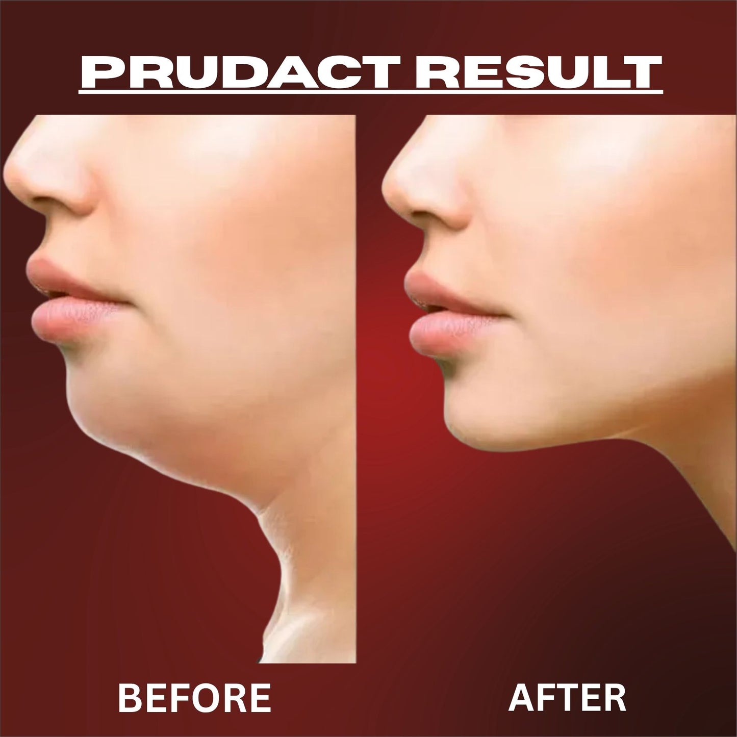 Before and after comparison of a nose job on a red background with 'Product Result' text.